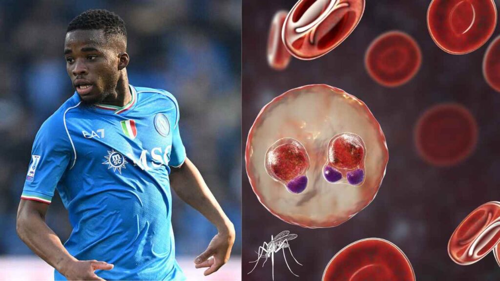 Come ha fatto Traorè del Napoli a prendere la malaria